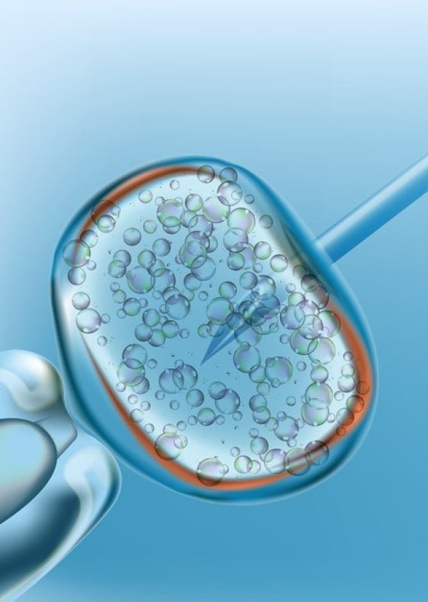 IVF 1